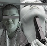 Coronal, basal, sagittal and axial CT cuts indicating entrance and ricochet of the bullet causing acute subdural hematoma on the left side (plates A, B, C, D). Digital subtraction angiography of left carotid (plate E), Post-operative axial CT cut post decompressive craniectomy (plate F), intraoperative sketch indicating primary repair of dura (G) and multiple axial CT views of post-op course up to cranioplasty (plates H, I and J).